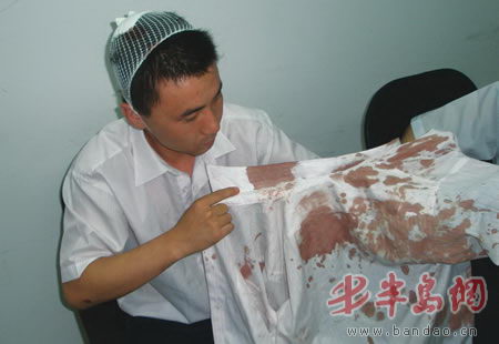 于经理在向记者展示血衣